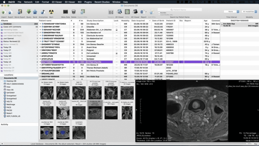 Osirix Dmg Image Not Recognized Osx Osirix Dmg Image Not Recognized Osx