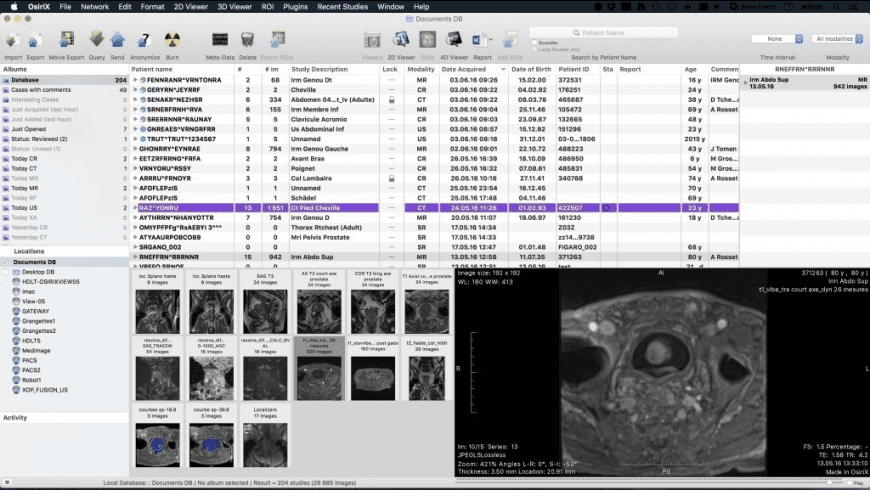 Dicom Viewers For Mac Dicom Viewers For Mac