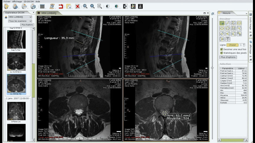 Dicom viewer free mac Dicom viewer free mac