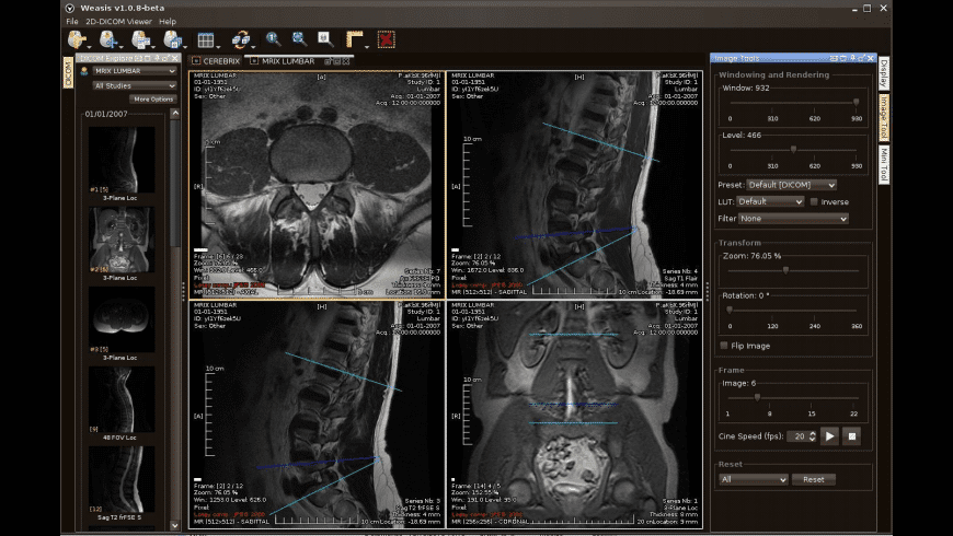 Download opencv android sdk Download opencv android sdk