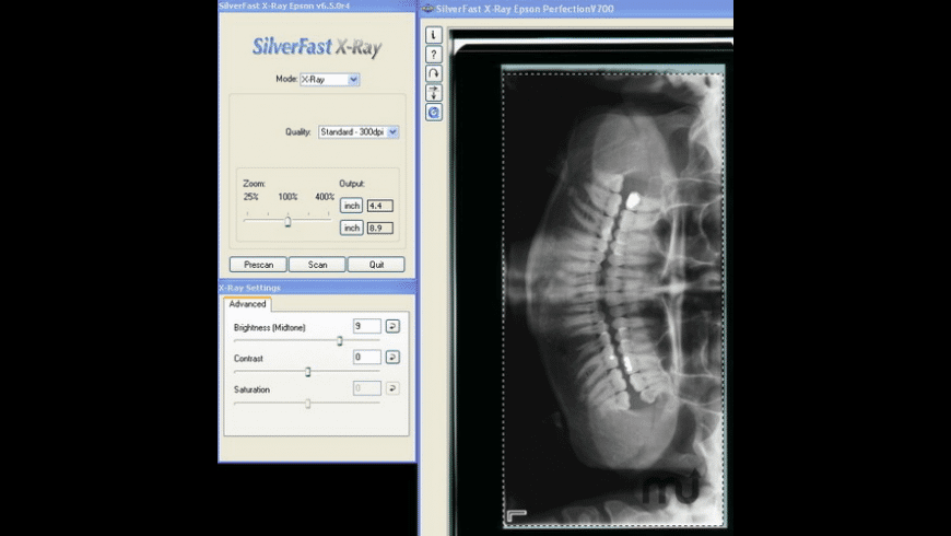 Software To View X-rays On A Mac Software To View X-rays On A Mac
